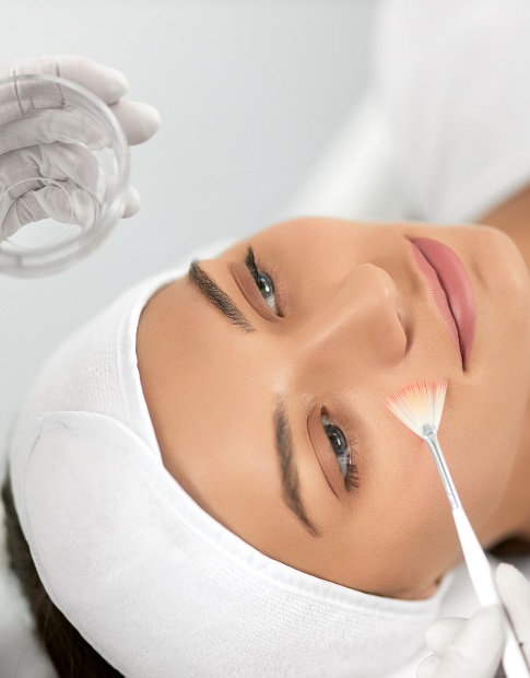 Chemical Peels
